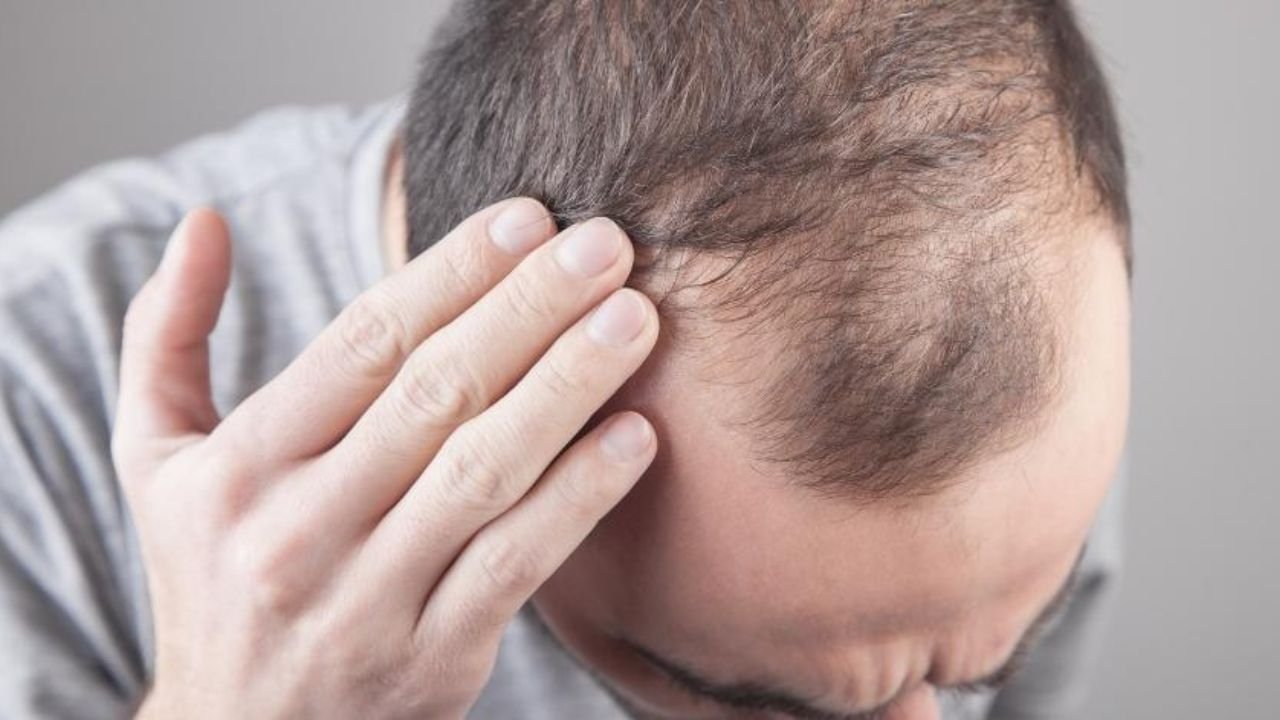 5 Things You’re Unknowingly Doing That Trigger Hair Fall in Your 20s